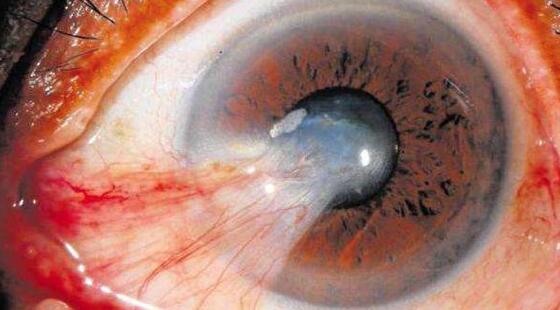 QQ截图20171207162818.jpg QQ截图20171207162818.jpg