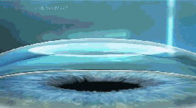 因为从手术原理来说,近视矫治手术是根据你需要 的近视度数,切削掉相应厚度的角膜,术后切削掉的角膜并不会再生长出来,所以,已经 的度数并不会复发1.png 因为从手术原理来说,近视矫治手术是根据你需要 的近视度数,切削掉相应厚度的角膜,术后切削掉的角膜并不会再生长出来,所以,已经 的度数并不会复发1.png