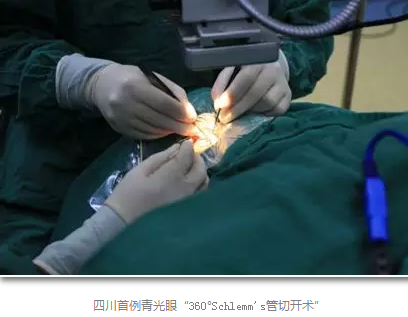 成都易游体育已经开展的青光眼手术有:引流阀 (钉)植入手术(2015年以来已200多 ),360°Schlemm's管切开术,激光CO2 辅助巩膜深层切除术,小梁切除术青(光眼)白(内障)联合手术。还有虹膜周切术、前房成形术、 虹膜复位术,睫状体冷冻术,小梁切开术和前房穿刺术等6.png 成都易游体育已经开展的青光眼手术有:引流阀 (钉)植入手术(2015年以来已200多 ),360°Schlemm's管切开术,激光CO2 辅助巩膜深层切除术,小梁切除术青(光眼)白(内障)联合手术。还有虹膜周切术、前房成形术、 虹膜复位术,睫状体冷冻术,小梁切开术和前房穿刺术等6.png