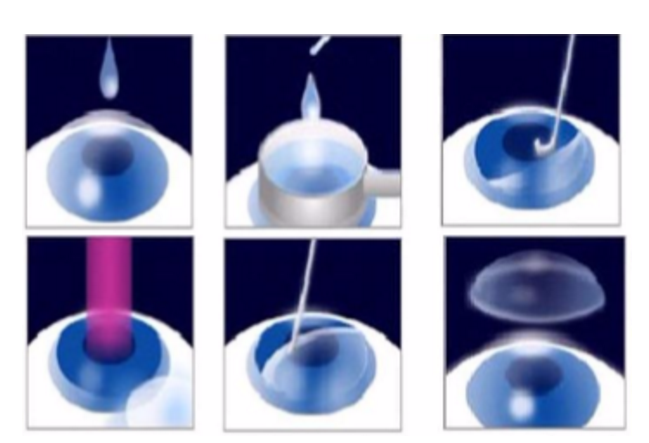 近视无法根治?但你可以这样做?易游体育“有爱就有希望”近视手术火热进行中32.png 近视无法根治?但你可以这样做?易游体育“有爱就有希望”近视手术火热进行中32.png