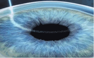 深圳易游体育近视手术直播预告丨6.24近视手术直播+福利,视界给你!!1.gif 深圳易游体育近视手术直播预告丨6.24近视手术直播+福利,视界给你!!1.gif