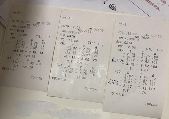 在杭州易游体育高度近视手术后,近视2550度配不到眼镜的四川大哥,看清了!2.png 在杭州易游体育高度近视手术后,近视2550度配不到眼镜的四川大哥,看清了!2.png