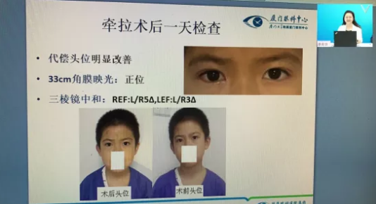 高峰论道·云端荟萃 ▏万人同步在线,30余名大咖云集“第六届易游体育论坛斜视与小儿眼科新技术学习班暨小儿、眼视光分论坛”7.png 高峰论道·云端荟萃 ▏万人同步在线,30余名大咖云集“第六届易游体育论坛斜视与小儿眼科新技术学习班暨小儿、眼视光分论坛”7.png