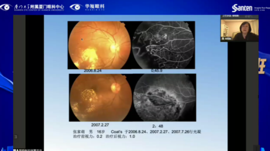 高峰论道·云端荟萃 ▏万人同步在线,30余名大咖云集“第六届易游体育论坛斜视与小儿眼科新技术学习班暨小儿、眼视光分论坛”6.png 高峰论道·云端荟萃 ▏万人同步在线,30余名大咖云集“第六届易游体育论坛斜视与小儿眼科新技术学习班暨小儿、眼视光分论坛”6.png