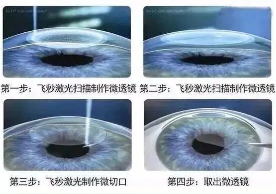 2021年征兵准备工作已经全面展开,视力不够的看过来2.png 2021年征兵准备工作已经全面展开,视力不够的看过来2.png