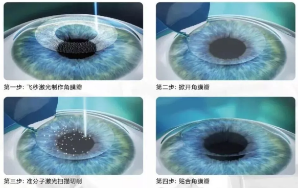 2021年征兵准备工作已经全面展开,视力不够的看过来3.png 2021年征兵准备工作已经全面展开,视力不够的看过来3.png