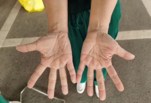 再获央媒报道点赞!易游体育医护团队用行动诠释战疫“最美身影”11.png 再获央媒报道点赞!易游体育医护团队用行动诠释战疫“最美身影”11.png