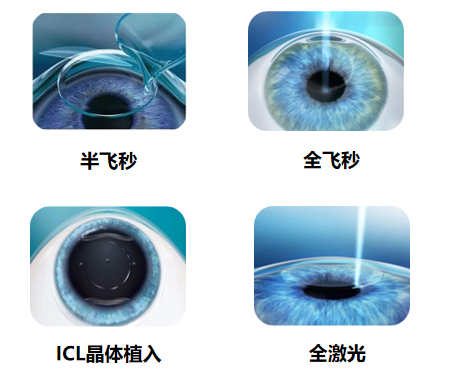 四种主流.png 四种主流.png