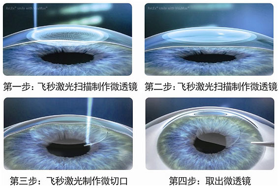 全飞秒.jpg 全飞秒.jpg